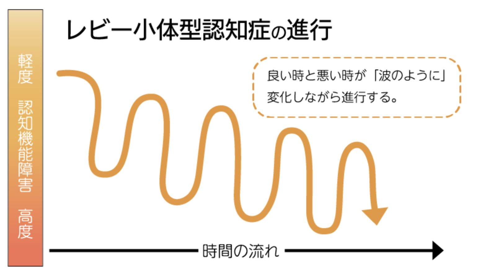 レビー小体型認知症の進行